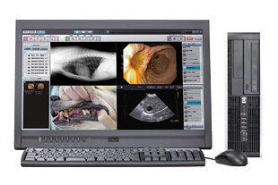 デジタルレントゲン