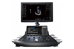 超音波画像診断装置,カラードップラー